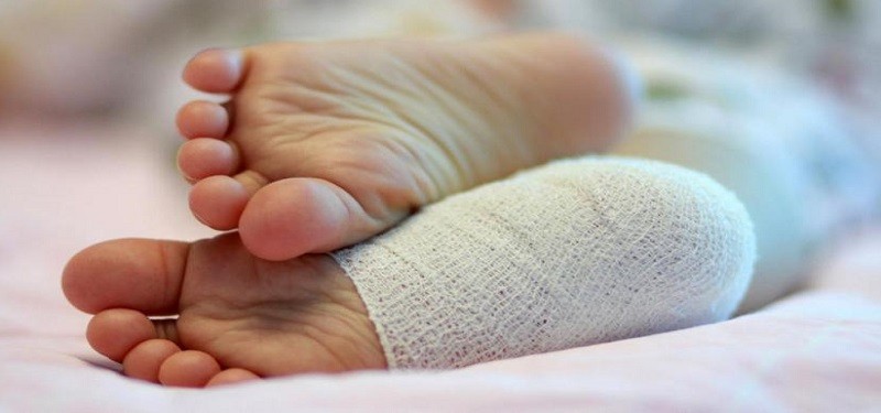 Toddler with a sprained ankle