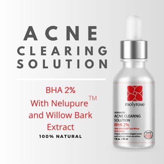 Acne Clearing Solution