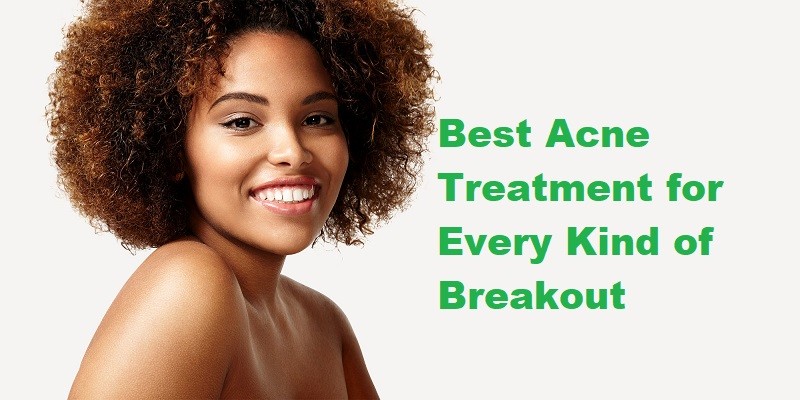 Best Acne Treatment