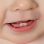 An Ultimate Guide for Complete Care for Baby Teeth