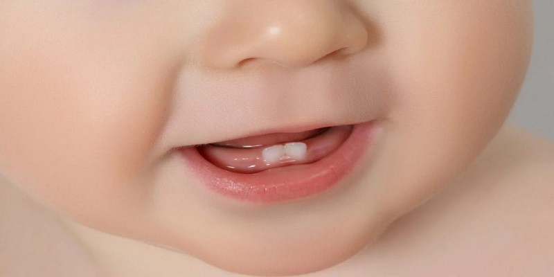 An Ultimate Guide for Complete Care for Baby Teeth