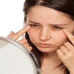 Can Early Pregnancy Cause Dark Circles Under Eyes