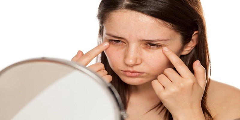 Can Early Pregnancy Cause Dark Circles Under Eyes