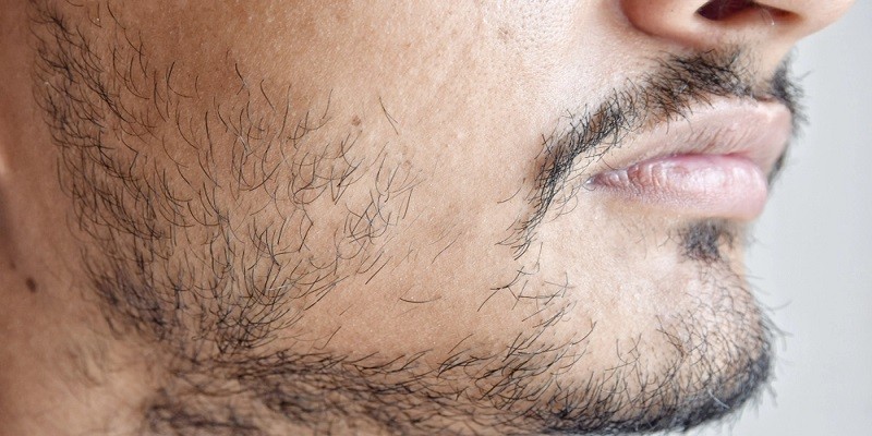 How To Grow Facial Hair As A Teenager