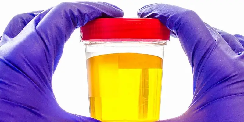 Can Bright Yellow Pee Be A Sign Of Pregnancy