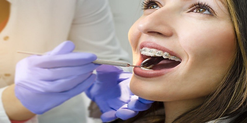 Can You Get Braces While Pregnant