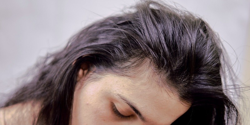 Can Women Use Minoxidil For Hair Loss