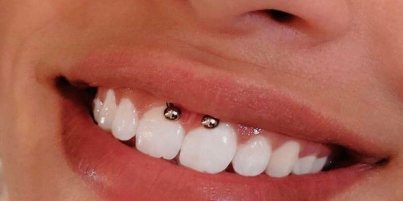 How To Clean A Smiley Piercing